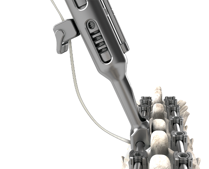 BandLoc Mechanism