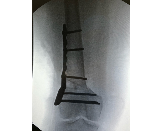 DFOS X-Ray