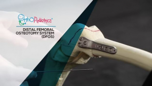 DFOS