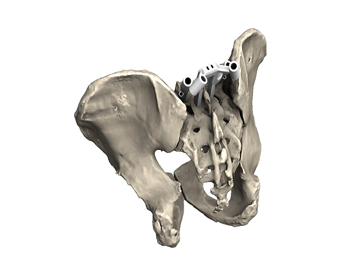 FireFly Skeleton Top View