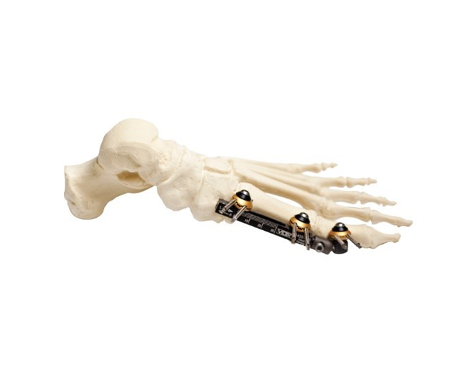 Mini Rail Skeleton