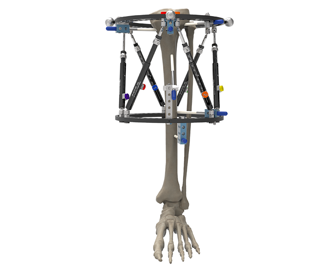 Orthex Frame