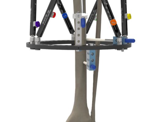 Orthex Frame Skeleton Example