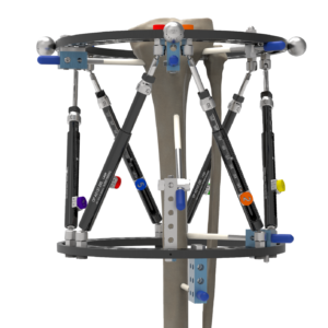 Orthex Frame Skeleton Example