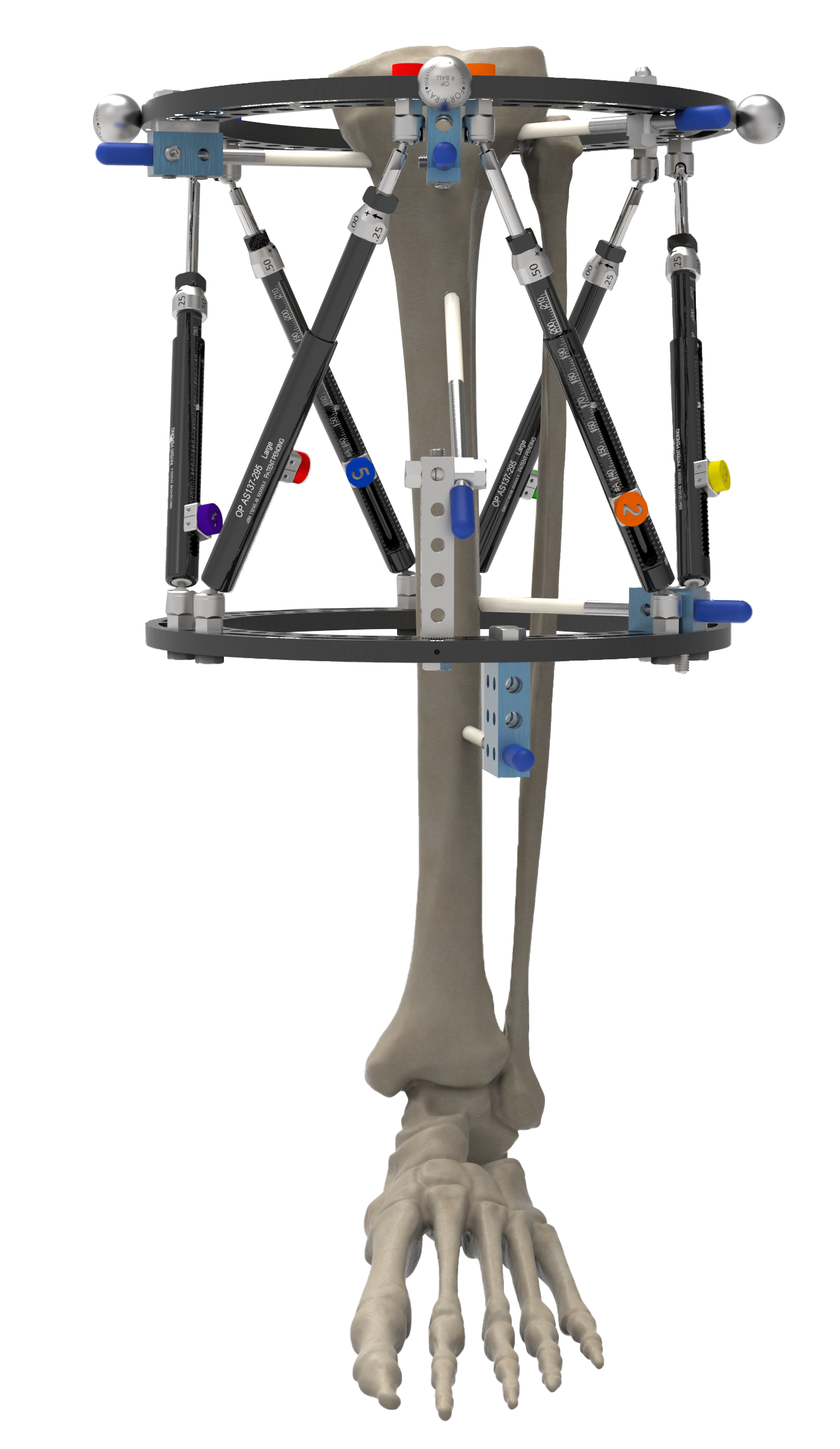 Orthex Frame Skeleton Example
