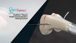 PediFlex Elastic Stable