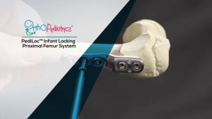 PediLoc Infant Locking Proximal Femur System