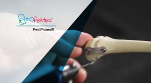 PediPlates