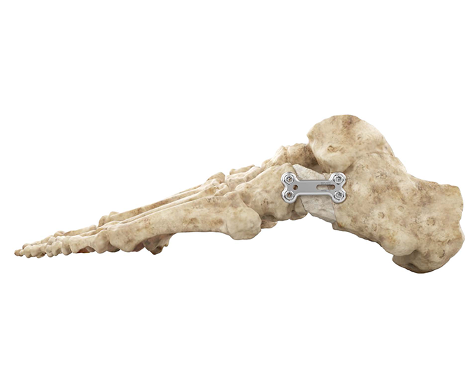 PediFoot Skeleton Side View