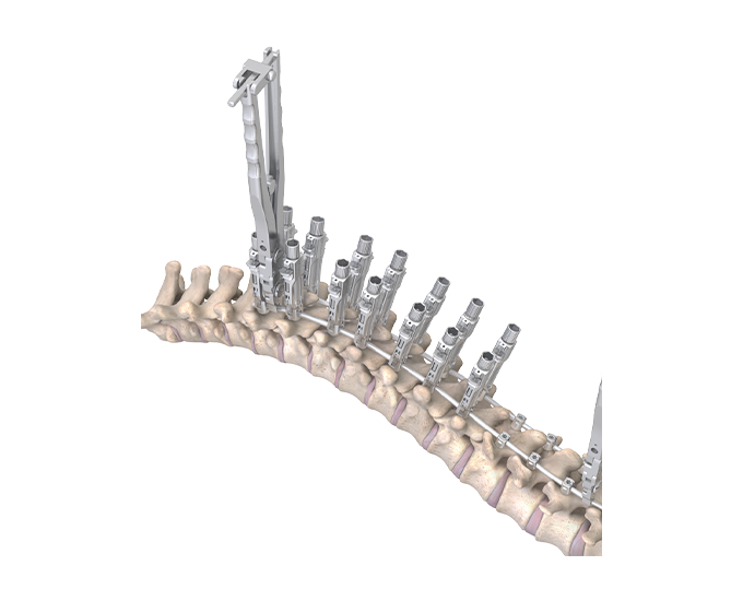 RESPONSE Skeleton