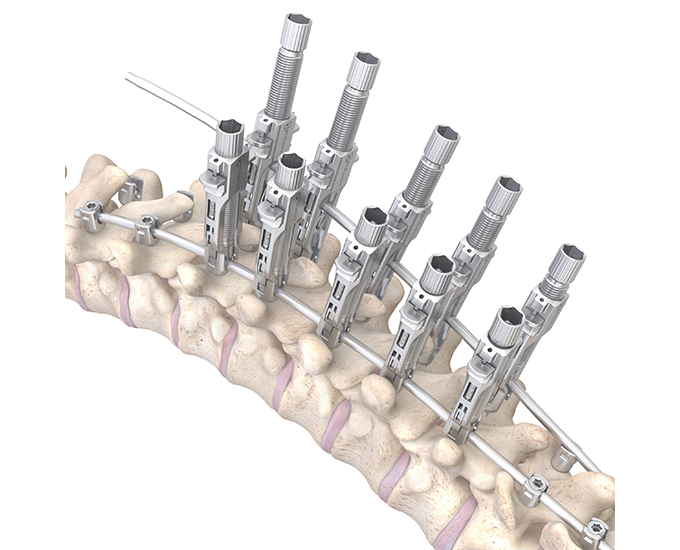 response skeleton