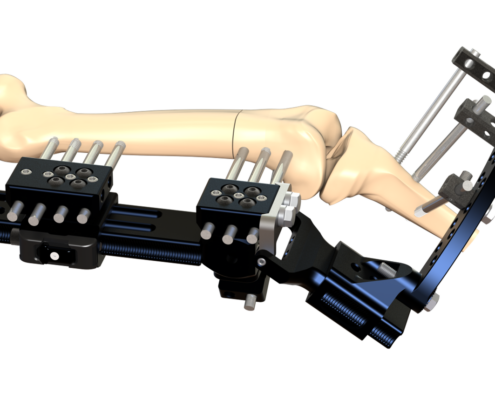 drive rail