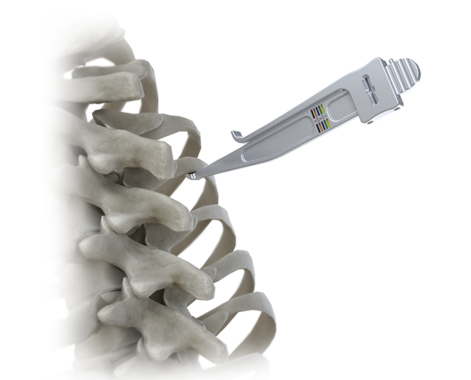 RESPONSE instrument with spine