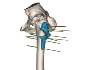 Image of a 3D Side model in the bone.