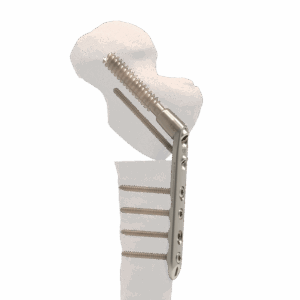 Pediatric Plating Platform™ | Hip (Trauma)