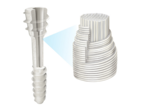 OSSIOfiber® Compression Screws
